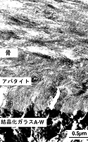 人工骨